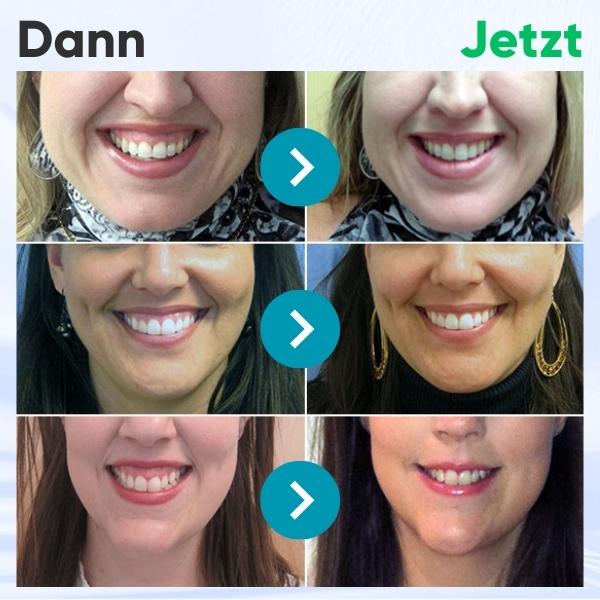 AEXZR™ Zahnfleisch-Therapie-Gel - Sichern Sie sich noch HEUTE Ihre 80% Rabatt!